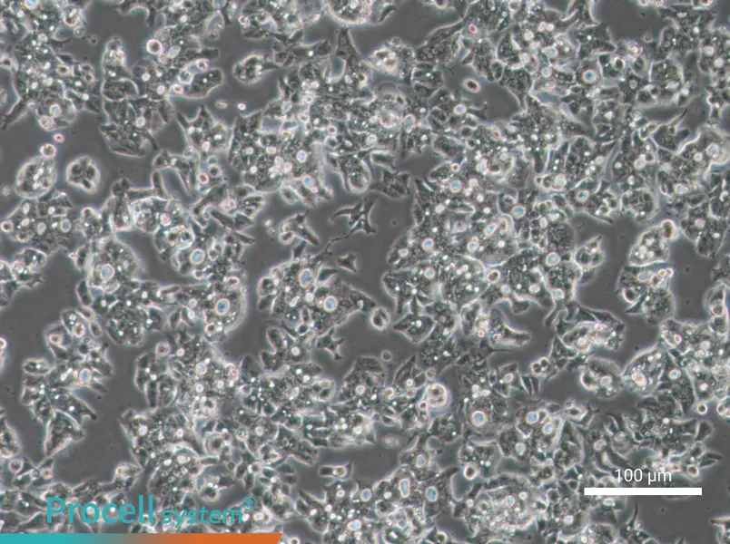 OE19 Cell Complete Medium - 1