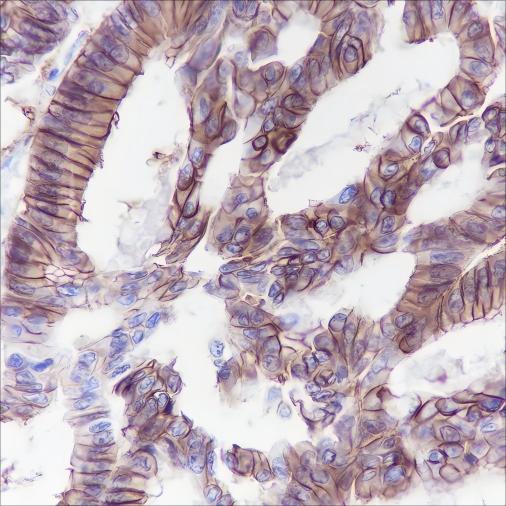 Recombinant Cadherin-17 Monoclonal Antibody-searchlist-1