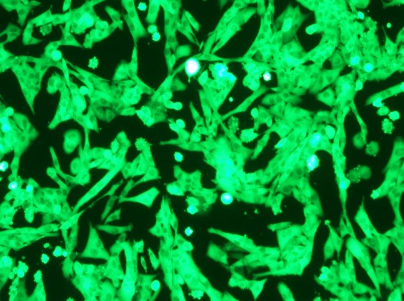 NCI-H446-GFP Cell Complete Medium - small - 10