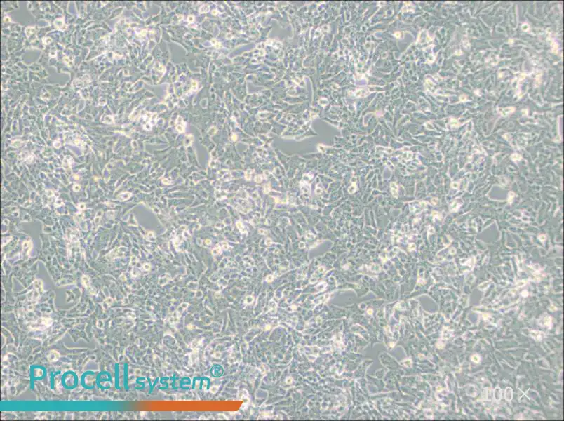 NCI-H295R Cell Complete Medium - 2