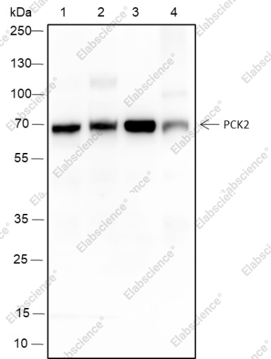 Recombinant PCK2 Monoclonal Antibody - 1