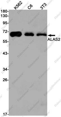 Recombinant ALAS2 Monoclonal Antibody - 1