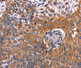 RDX Polyclonal Antibody - 2
