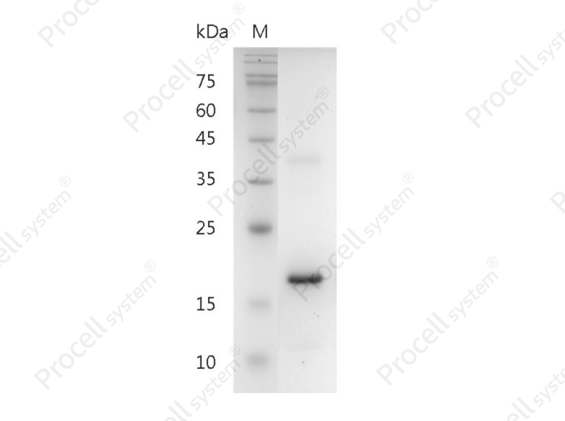 IL-37/IL-1F7/IL-1H4, Human, Recombinant
