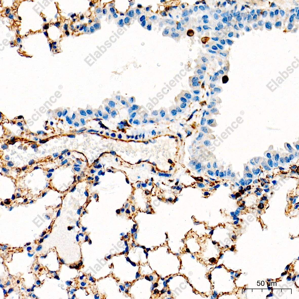 (KO Validated) Vimentin Polyclonal Antibody - 6