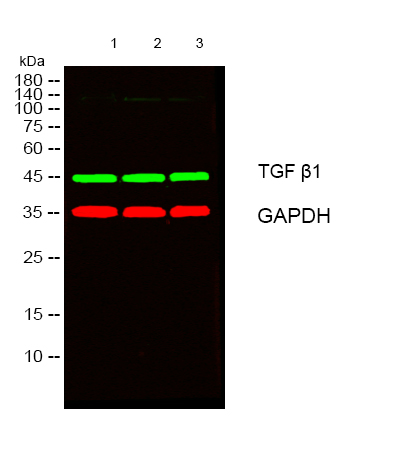 Recombinant TGF β1 Monoclonal Antibody - 2