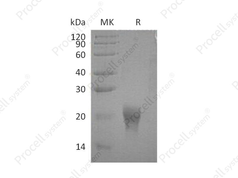 IL-5 (C-6His), Human, Recombinant
