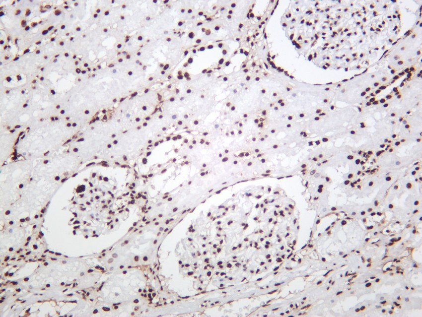 Recombinant Histone H3 Monoclonal Antibody - 3
