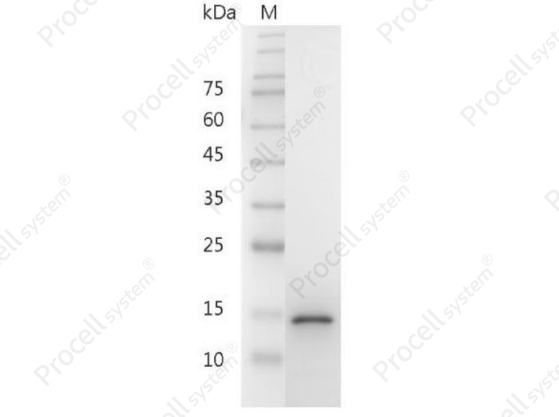 GDNF/ATF/HSCR3, Mouse, Recombinant