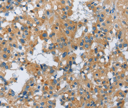 FGF9 Polyclonal Antibody - 2