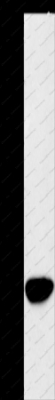 AKR1D1 Polyclonal Antibody - 1