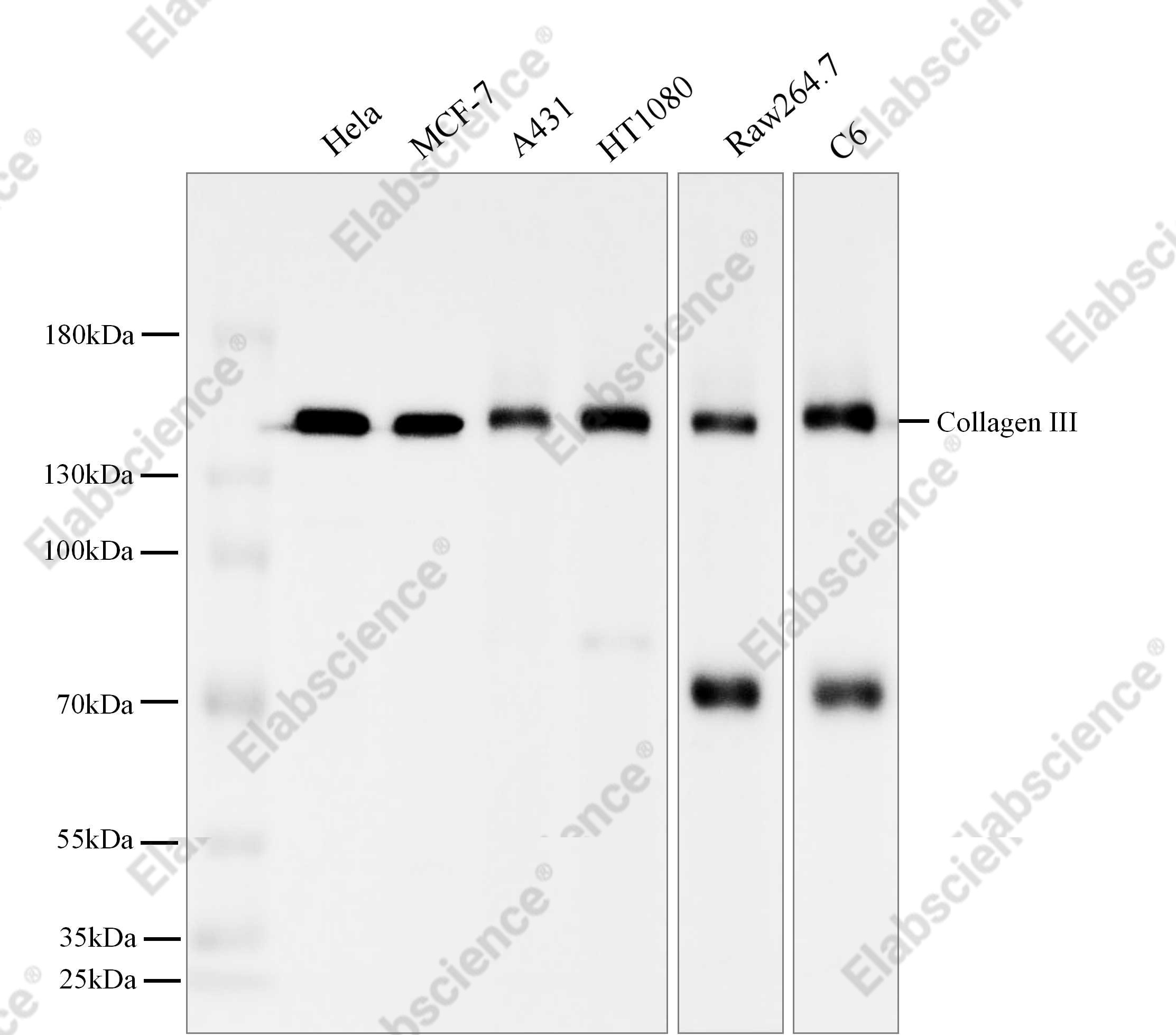 Recombinant Collagen III Monoclonal Antibody - 2
