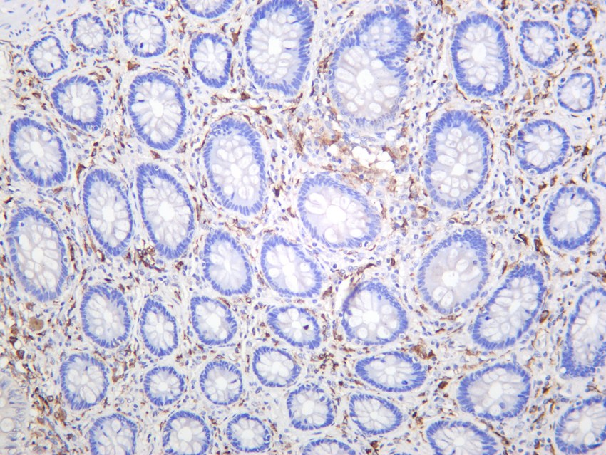 Recombinant CD206/MRC1 Monoclonal Antibody - 2