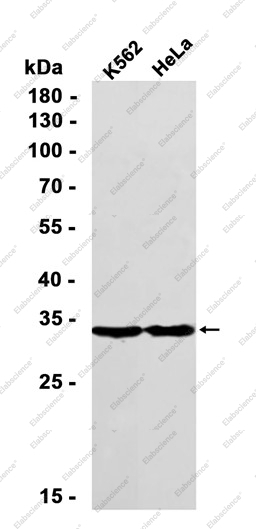 Recombinant TMEM192 Monoclonal Antibody - 1