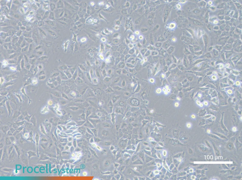 NCI-H2172NCI-H2172 - 1
