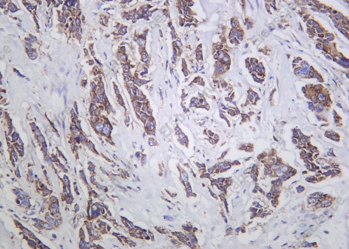 Recombinant G3BP1 Monoclonal Antibody - 1