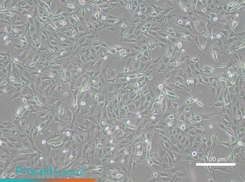 IBRS-2 [IB-RS-2] Cell Complete Medium - 1