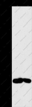 MB Polyclonal Antibody - 1