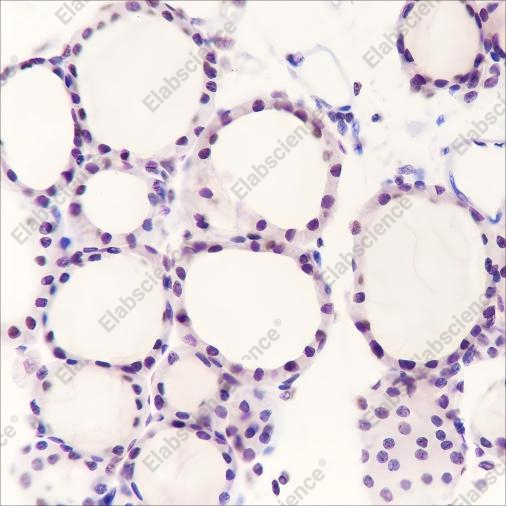 Recombinant PAX8 Monoclonal Antibody - 2