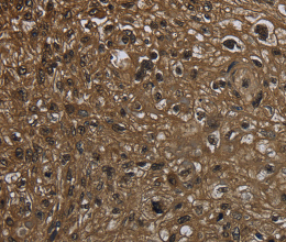 GLO1 Polyclonal Antibody - 3