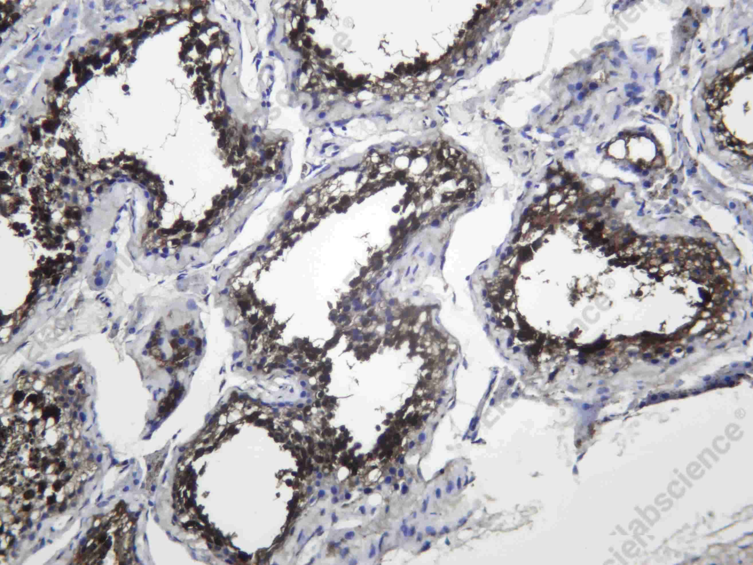 Recombinant HSP72 Monoclonal Antibody - 3