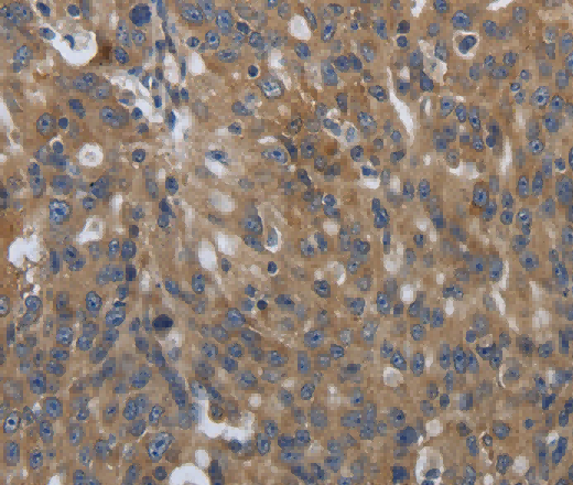 SOCS1 Polyclonal Antibody - 3