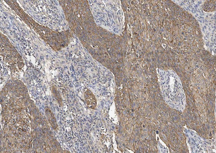 TROP2/TACSTD2 Monoclonal Antibody - 8