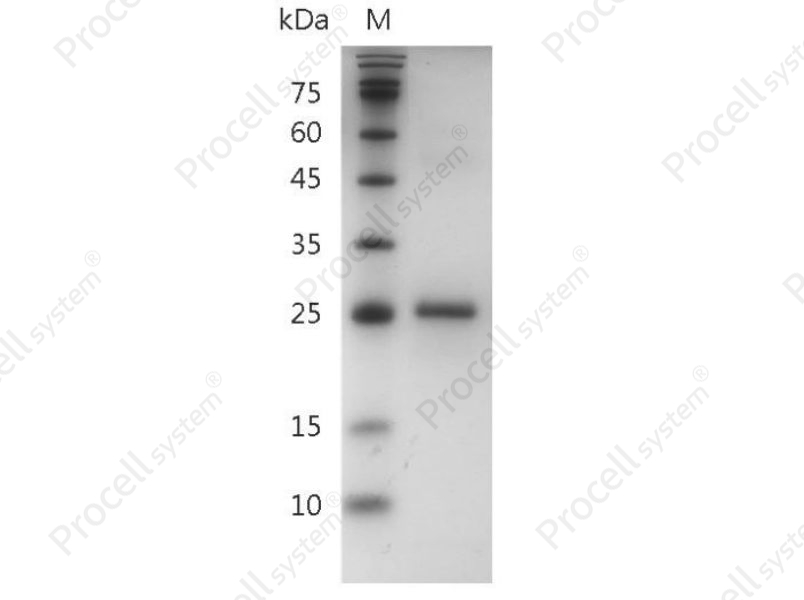 IL-34/2010004A03Rik, Il34, Mouse, Recombinant