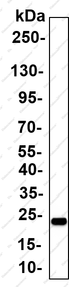 Recombinant NDUFB9 Monoclonal Antibody - 5