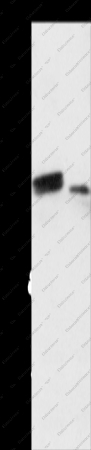 RARB Polyclonal Antibody - 1