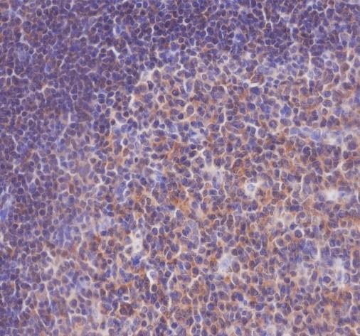 Recombinant SHIP-1 Monoclonal Antibody - 3