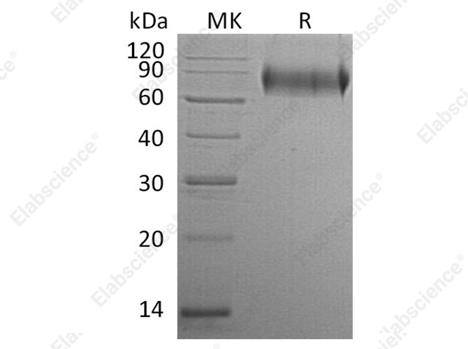 Recombinant Human E-Selectin/SELE Protein (His Tag) - 1