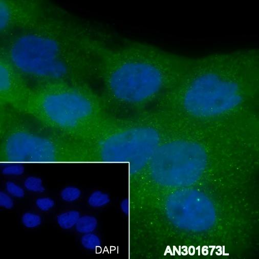 Recombinant Thrombomodulin Monoclonal Antibody - small - 3