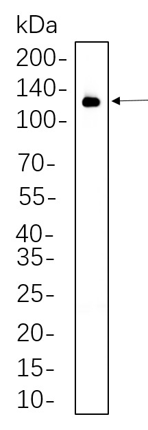Recombinant VCAM1 Monoclonal Antibody-searchlist-1