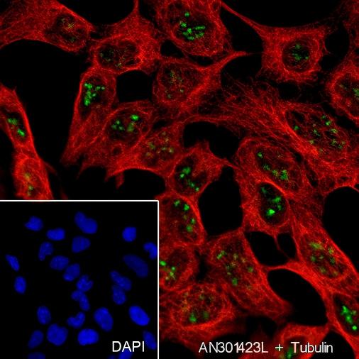 Recombinant AATF Monoclonal Antibody - small - 4