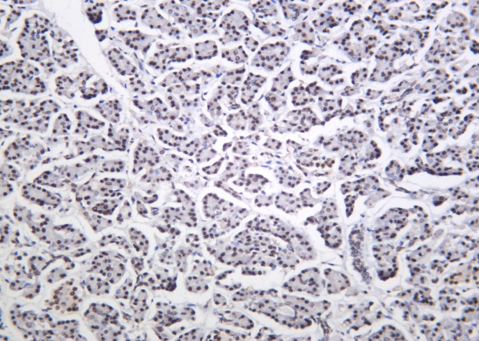 Recombinant Cdk9 Monoclonal Antibody-searchlist-1