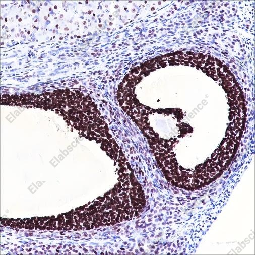 Recombinant FOXL2 Monoclonal Antibody - 4