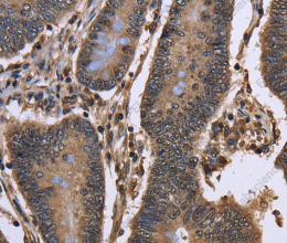 DCP1A Polyclonal Antibody - 3