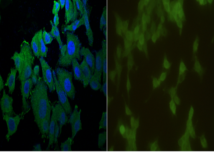 CD40/TNFRSF5 Monoclonal Antibody - small - 2