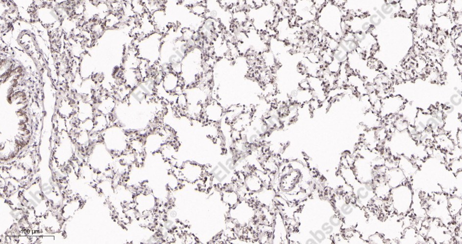 Recombinant ATF-4 Monoclonal Antibody - 3