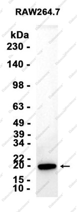 Recombinant UBE2C Monoclonal Antibody - 1
