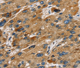 SULT1B1 Polyclonal Antibody - 3
