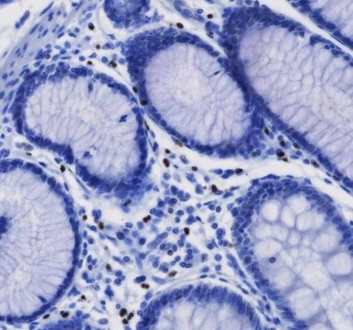 Recombinant GATA1 Monoclonal Antibody - small - 2