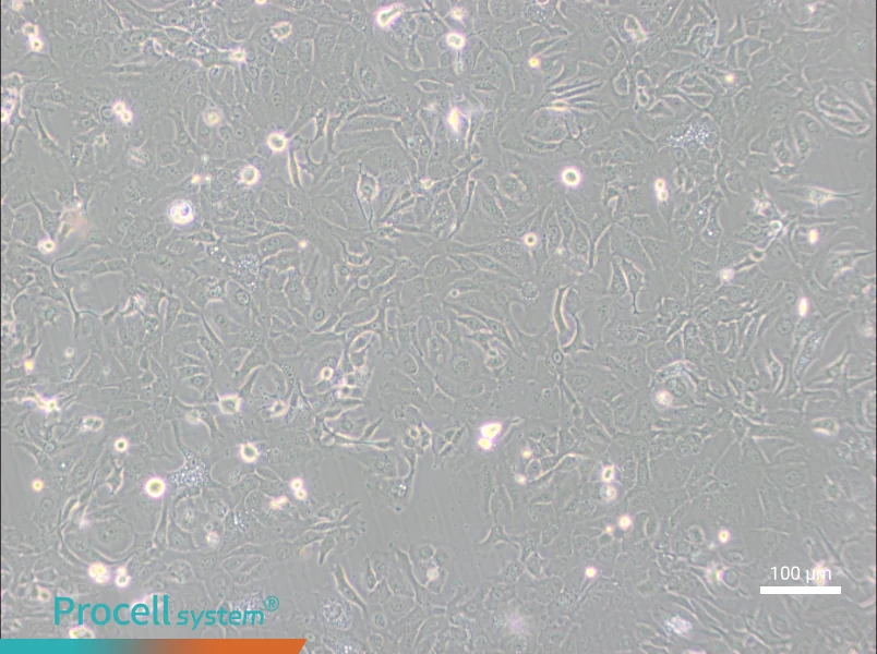 NCI-H1568 [H1568]NCI-H1568 [H1568] - 2