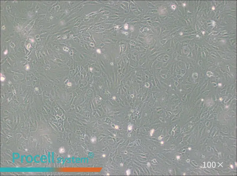 PUMC-HUVEC-T1 Cell Complete Medium - 1