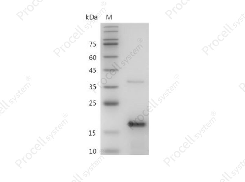 FGF-2/bFGF/FGF-b, Mouse, Recombinant