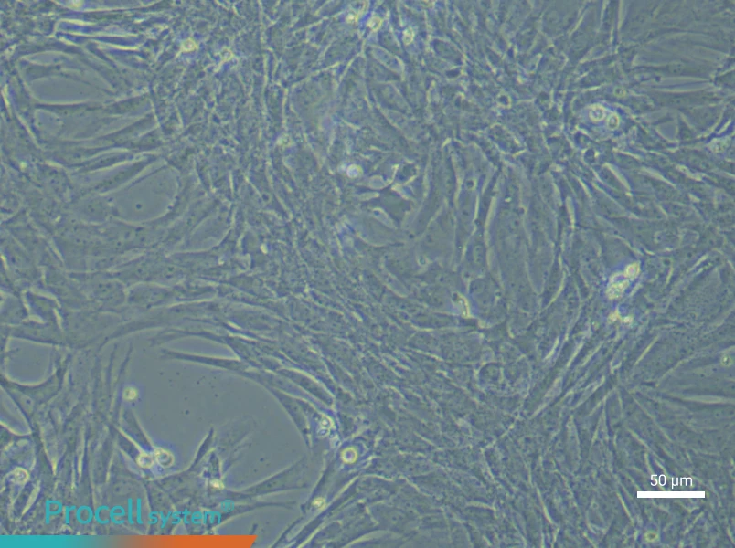 Rat Pulmonary Artery Smooth Muscle (Primary cell immortalization) Cell Complete MediumRat Pulmonary Artery Smooth Muscle (Primary cell immortalization) Cell Complete Medium - 5