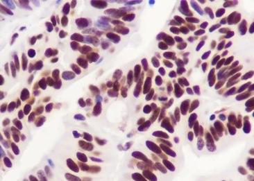 Recombinant SP1 Monoclonal Antibody-searchlist-2