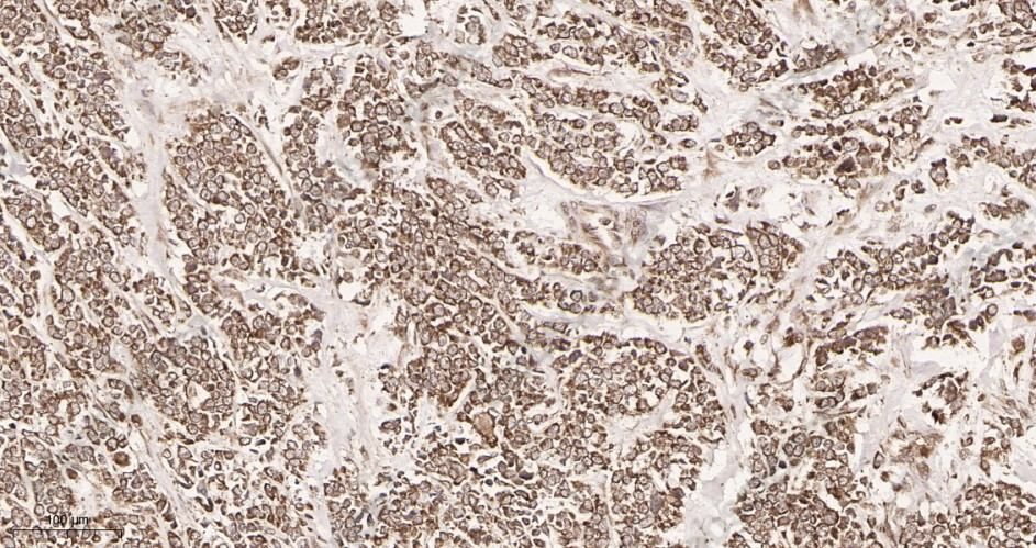 Recombinant Stromal Interaction Molecule 1 Monoclonal Antibody - 2