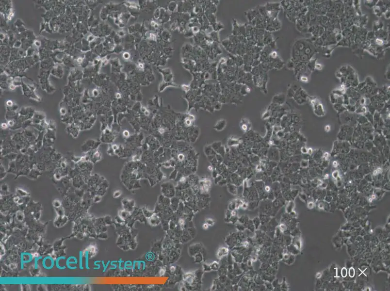 NCI-H1573 Cell Complete Medium - 1